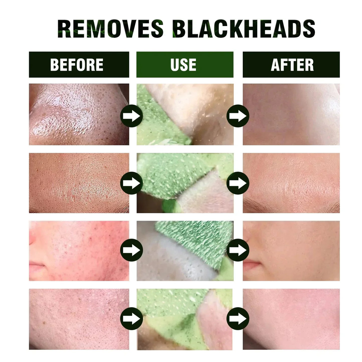 Blackhead Remover Acne Skincare Green Tea Mask Shrink Pore Facial